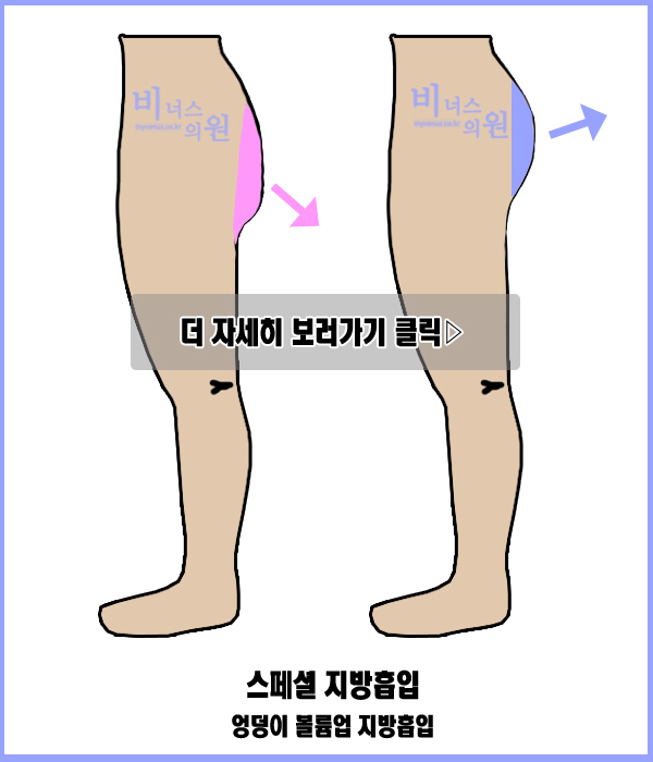 허벅지5.jpg