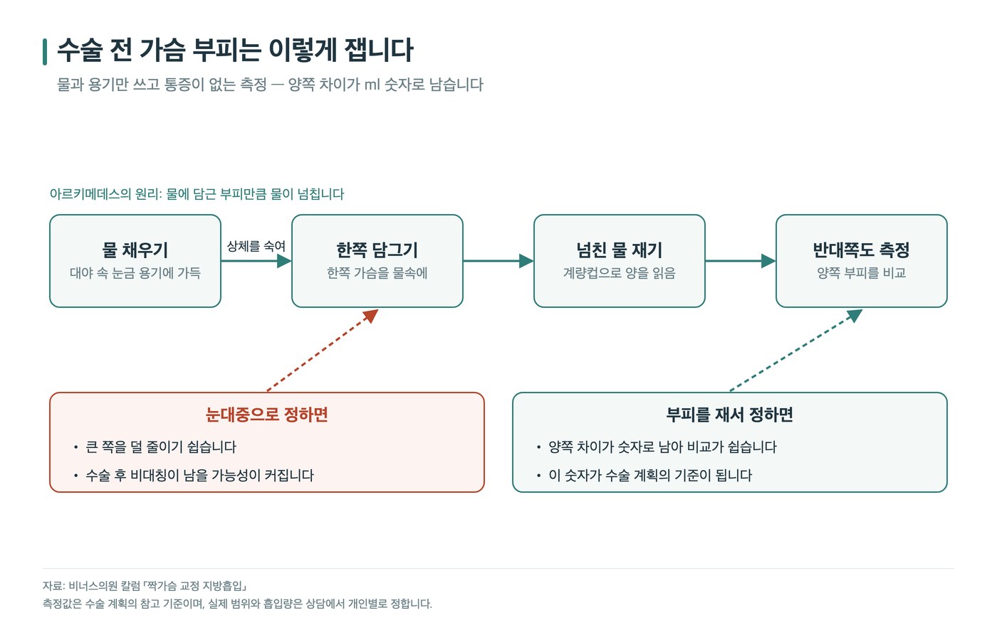 수술 전 가슴 부피 측정 4단계 흐름도 — 물 채우기, 한쪽 담그기, 넘친 물 재기, 반대쪽도 측정