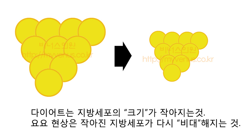 지방흡입 다이어트차이 (2).jpg