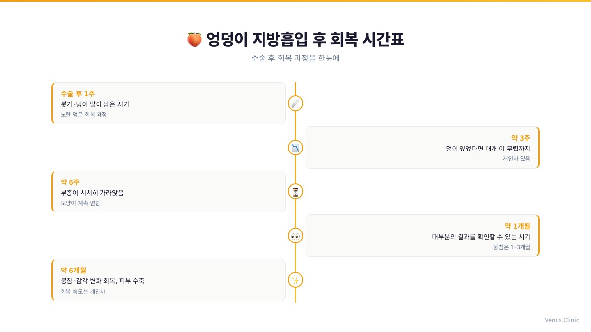 엉덩이 지방흡입 후 회복 시간표 인포그래픽 1주 3주 6주 1개월 6개월 타임라인