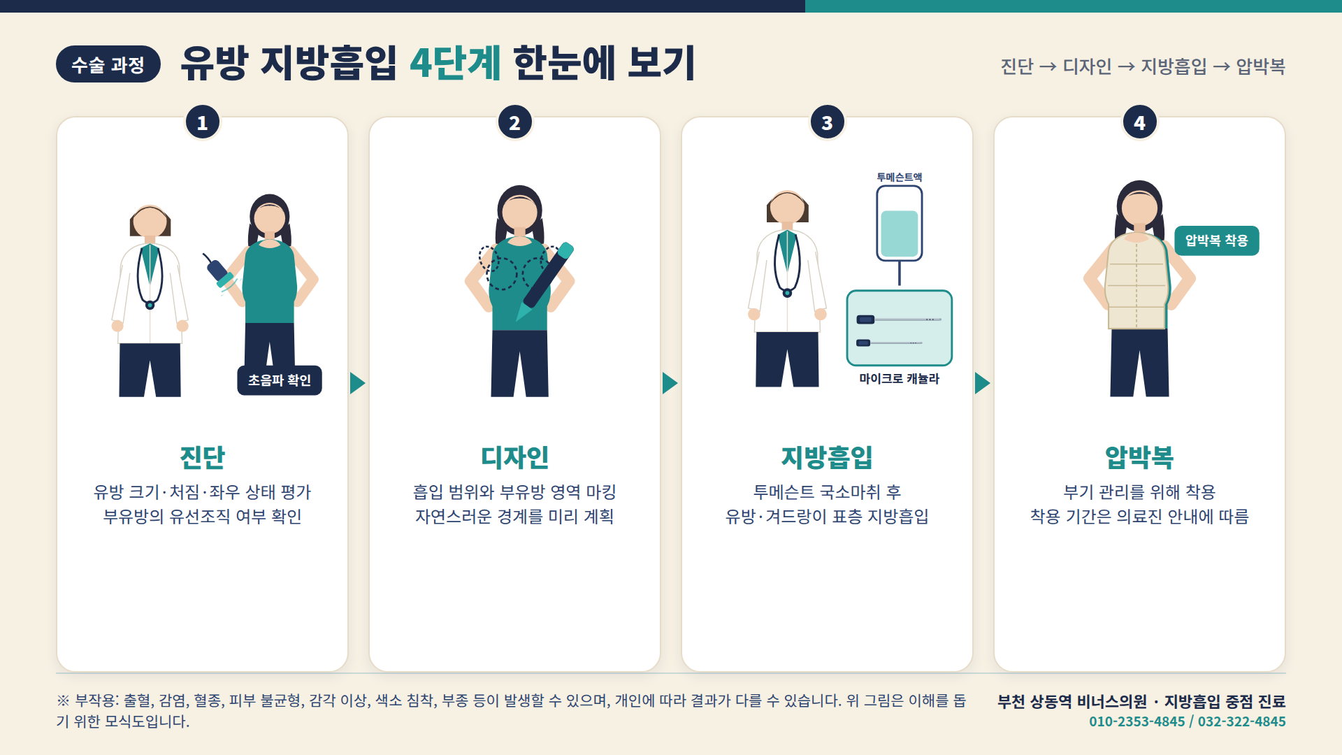 진단→디자인→지방흡입→압박복 4단계 수술 과정 인포그래픽