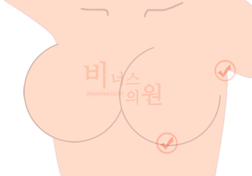 가슴2.jpg