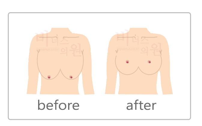 가슴.jpg