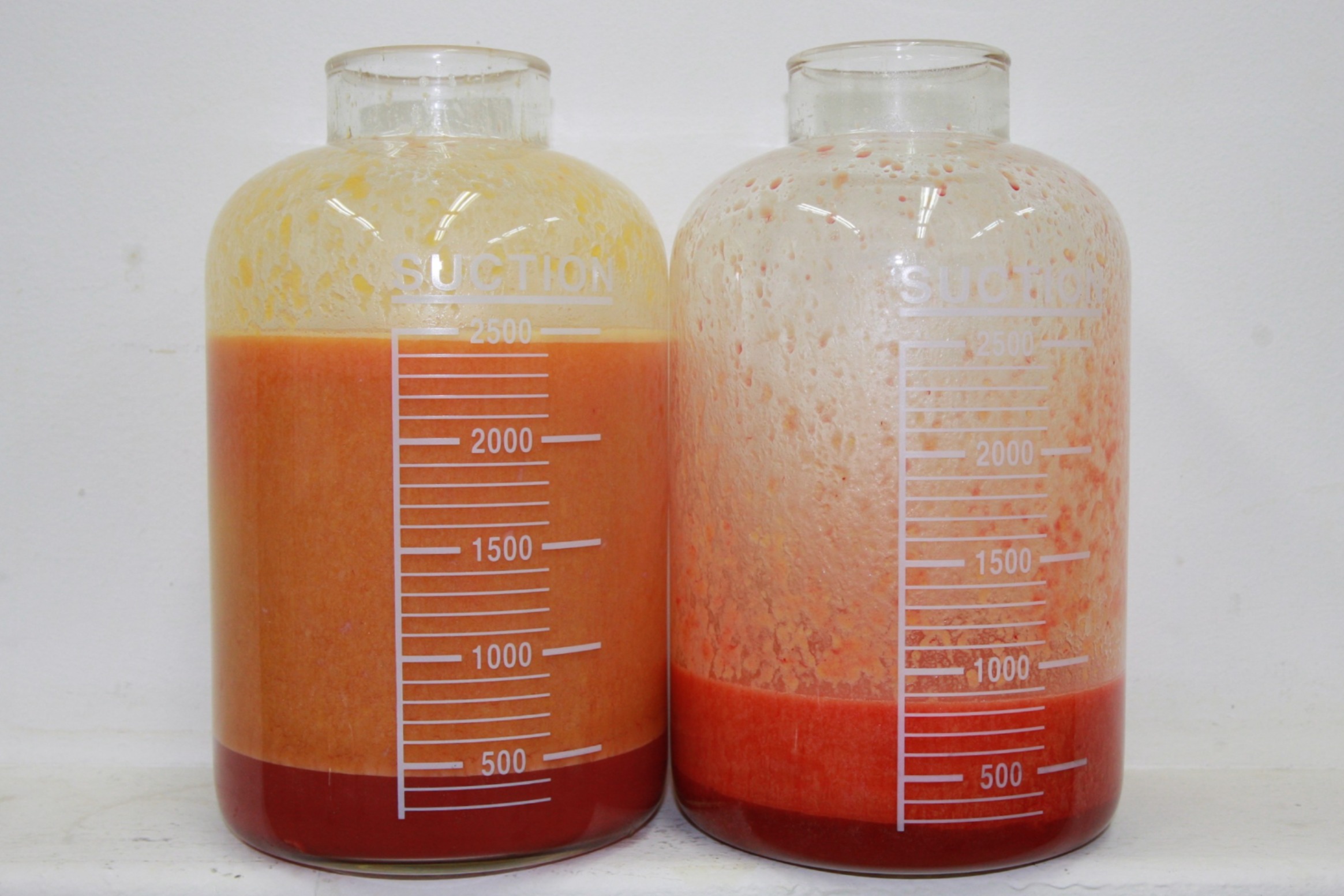 대용량복부지방흡입 복부지방흡입 옆구리지방흡입 미니지방흡입 아랫배지방흡입 윗배지방흡입 러브핸들지방흡입 전측복부지방흡입 뱃살지방흡입 뱃살빼기 복부지방흡입효과 복부지방흡입경과 복부지방흡입후기 복부지방흡입부작용 복부지방흡입울퉁불퉁 복부지방흡입 멍 부기 복부지방흡입고주파 (3).JPG