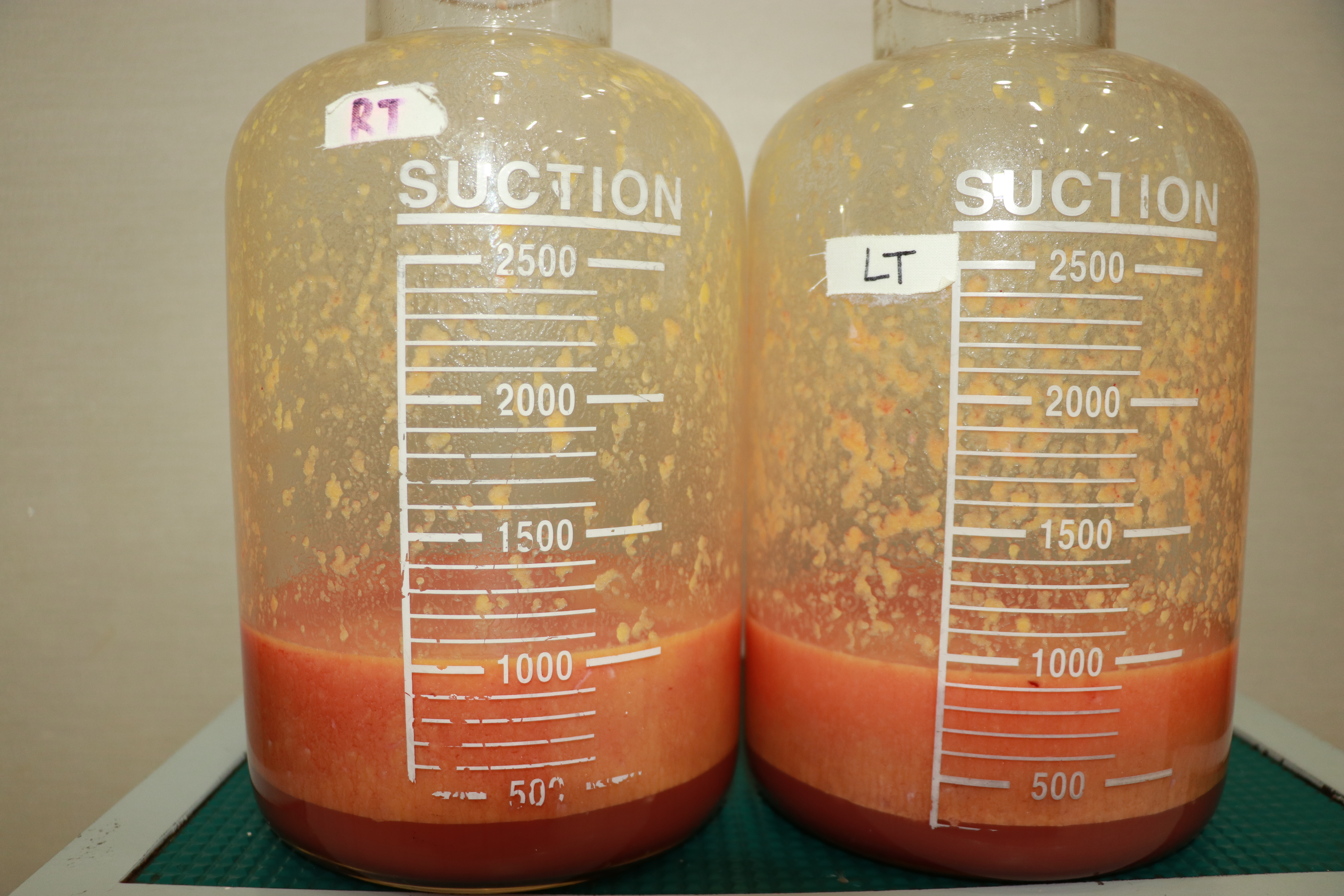 팔뚝지방흡입 지방량.JPG