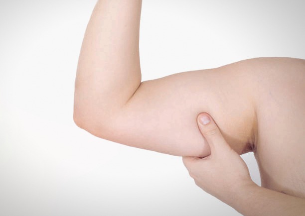 팔뚝살빼기 팔뚝살지방흡입 팔지방흡입 대용량팔뚝지방흡입 미니팔뚝지방흡입 처진팔뚝살 팔뚝지방흡입후관리 후기 경과 .jpg