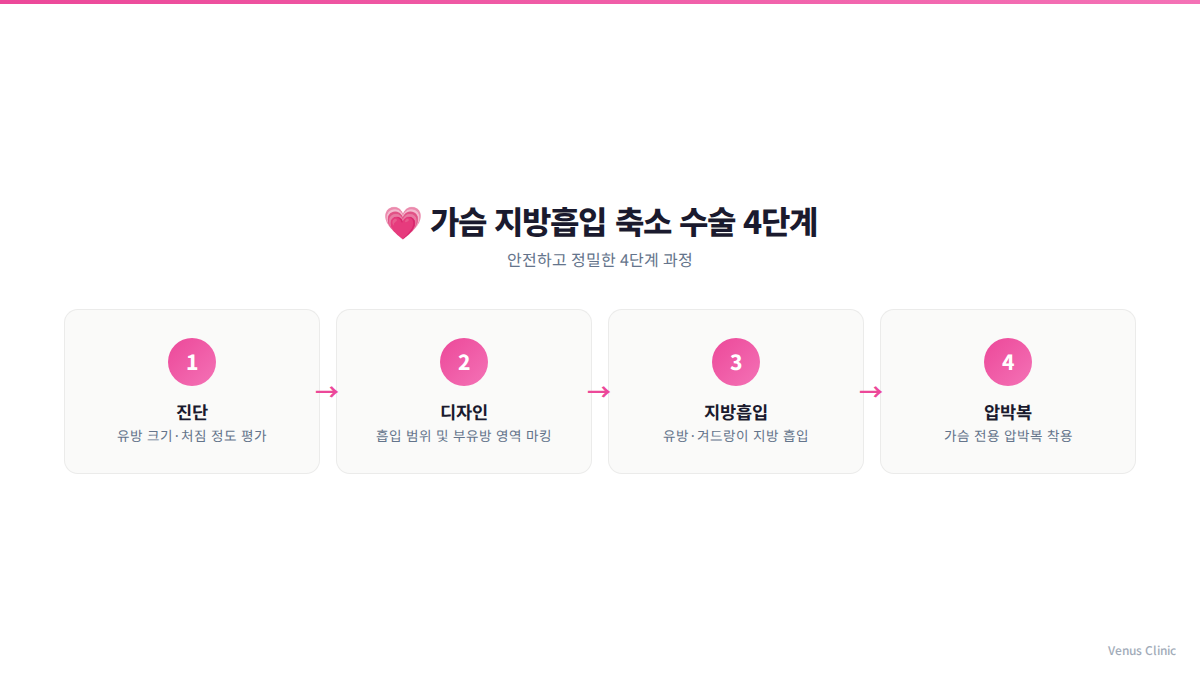 가슴축소 지방흡입 수술 단계 인포그래픽 — 1절개구→2투메슨트→3심층흡입→4표층흡입→5균형조율