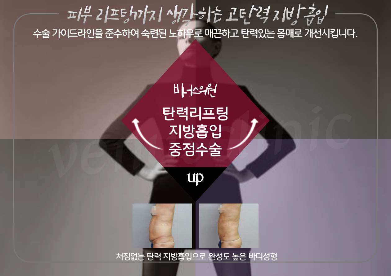 제목을-입력해주세요.-004.png