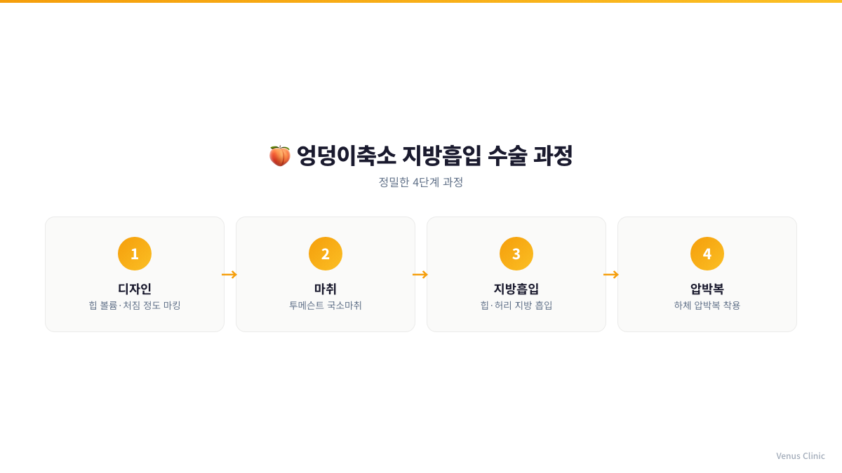 엉덩이축소 지방흡입 수술 4단계 과정 인포그래픽