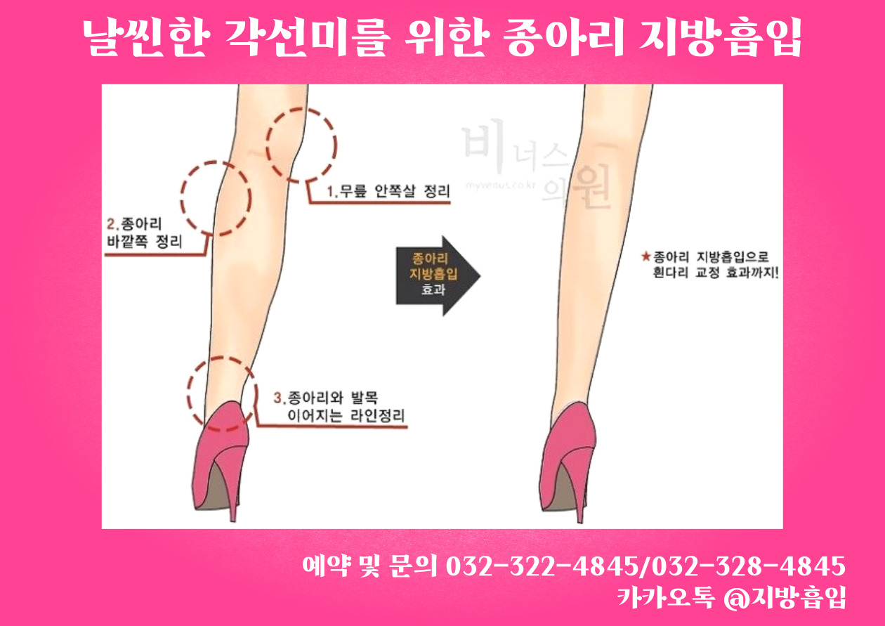 종아리지방흡입-003 (1).jpg