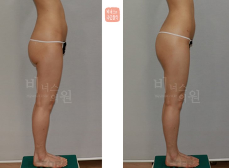 화면 캡처 2022-03-17 135723.JPG