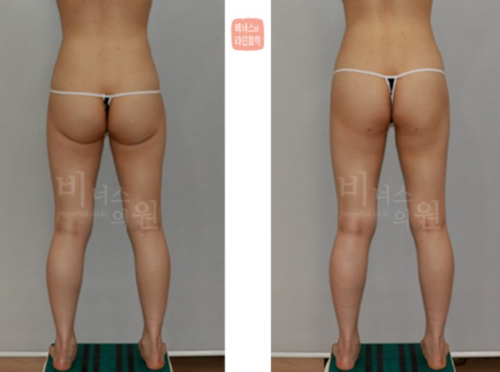 화면 캡처 2022-03-17 135808.JPG