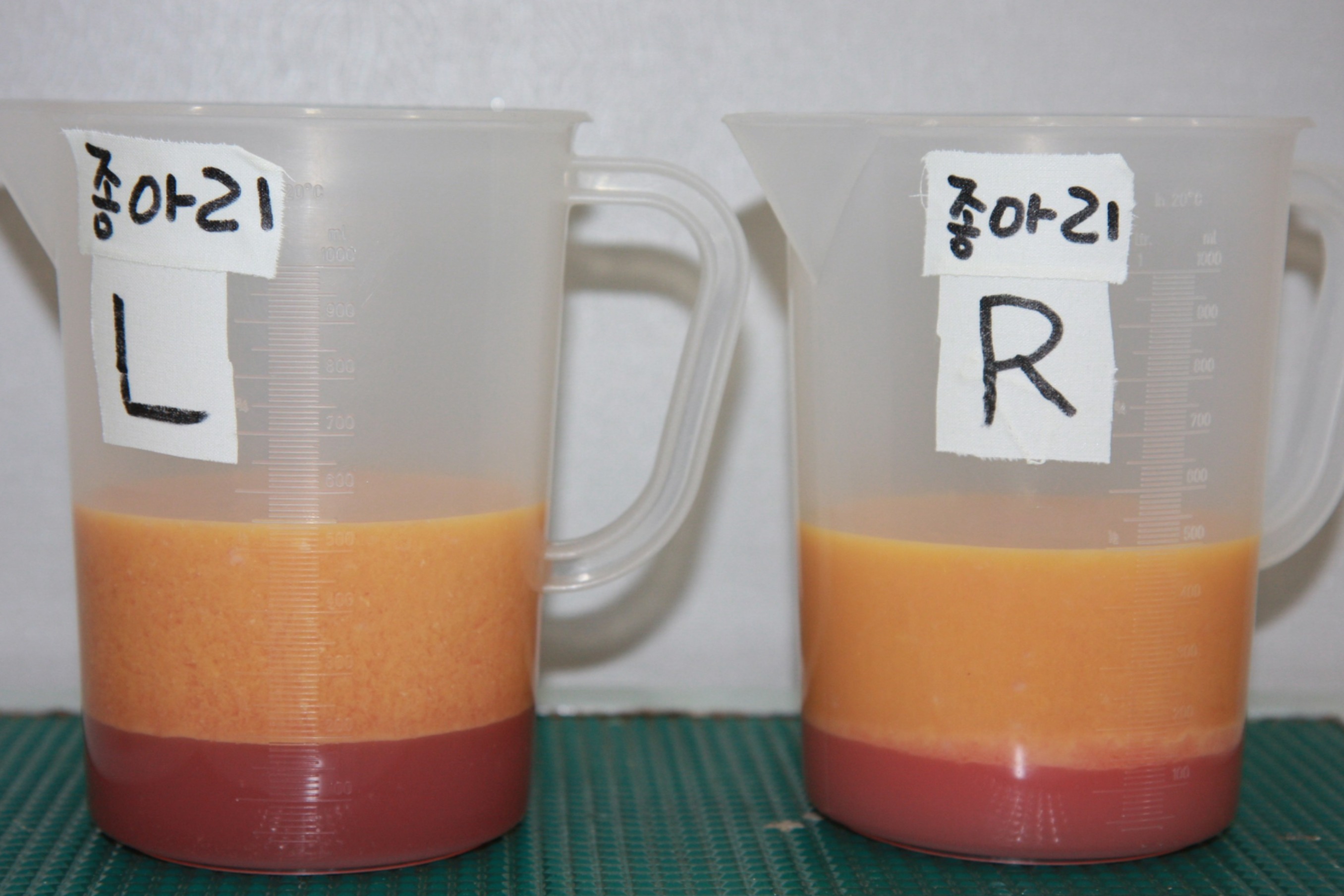 종아리지방흡입 종아리지방흡입부작용 종아리지방흡입부작용 종아리지방흡입회복기간 종아리지방흡입효과 종아리수술전후후기 종아리지방흡입경과 종아리지방흡입붓기 발목지방흡입 무릎지방흡입 종아리 알 종아리부종빼는법 종아리근육주사 종아리지방흡입지방량 종아리보톡스.jpg