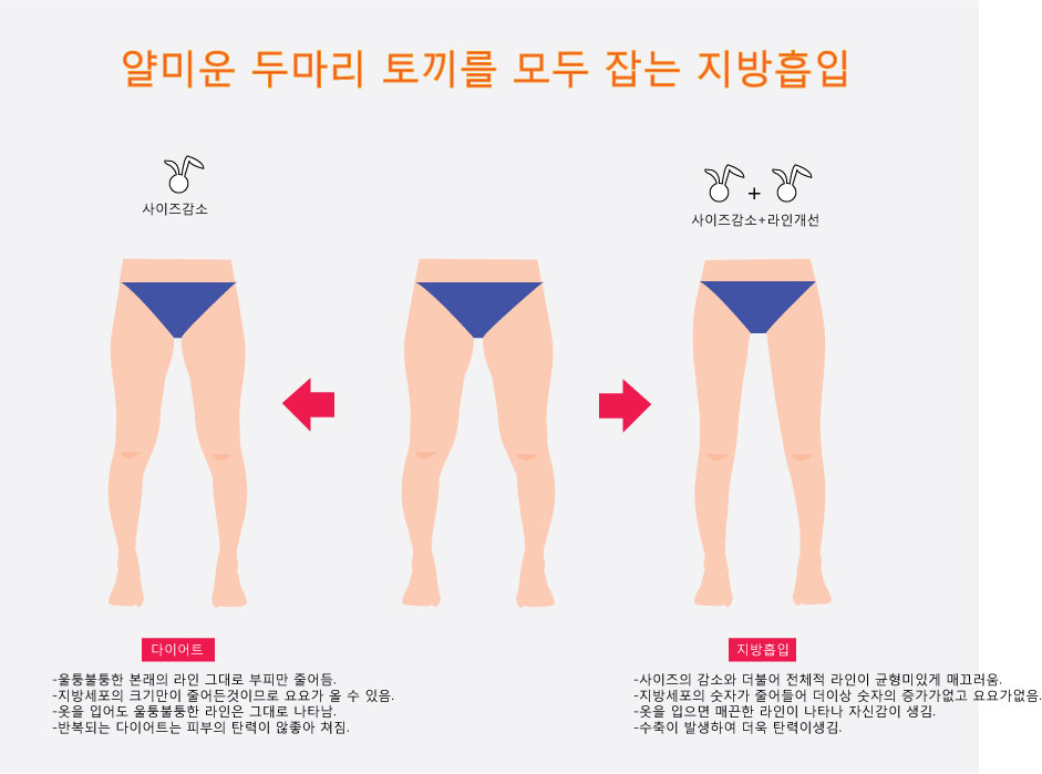 허벅지지방흡입과-다이어트.jpg