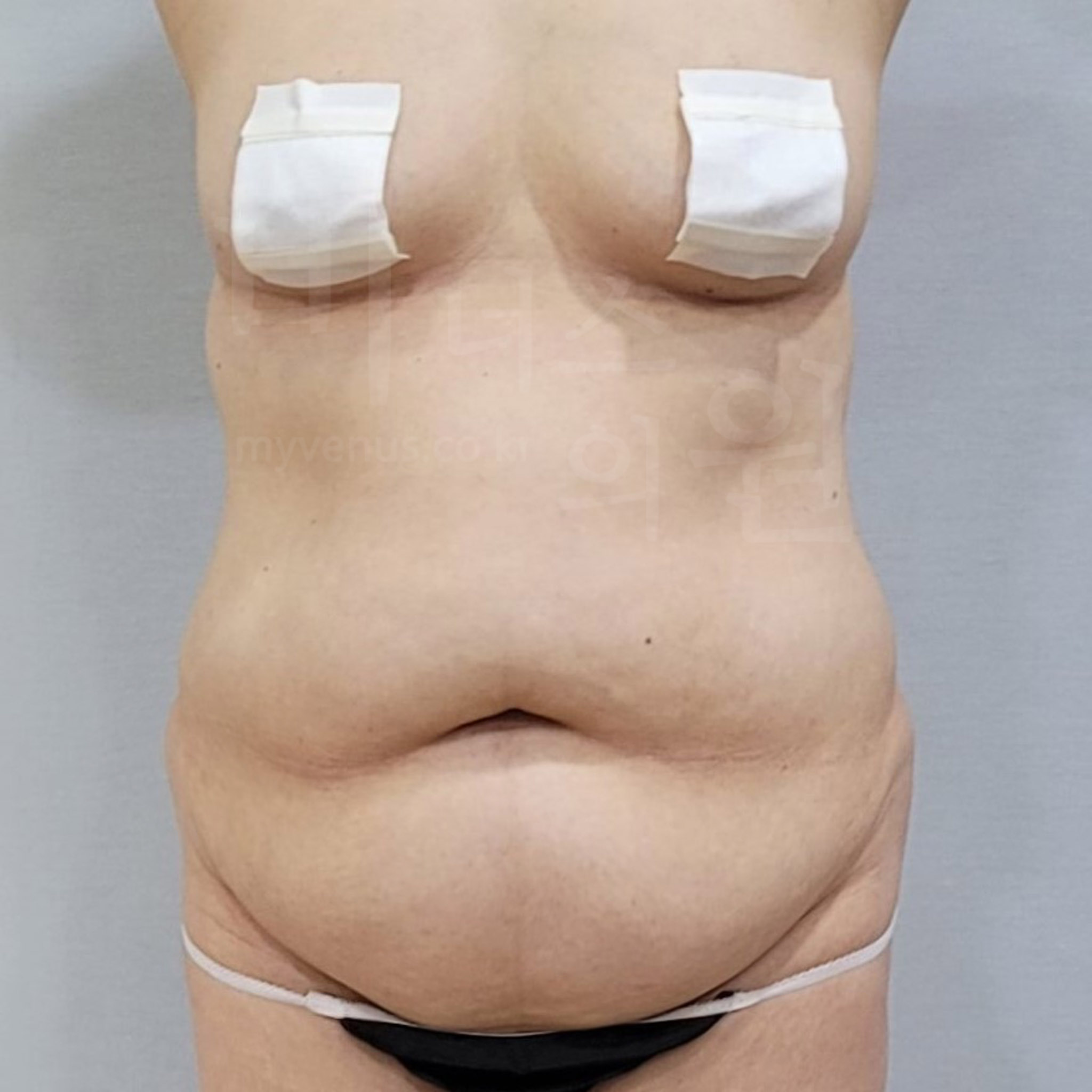 20250621 - 복사본.jpg