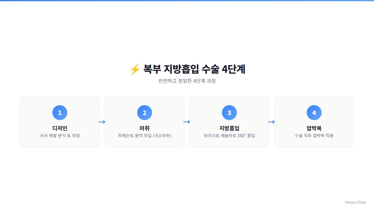 복부 지방흡입 수술 4단계 과정 인포그래픽