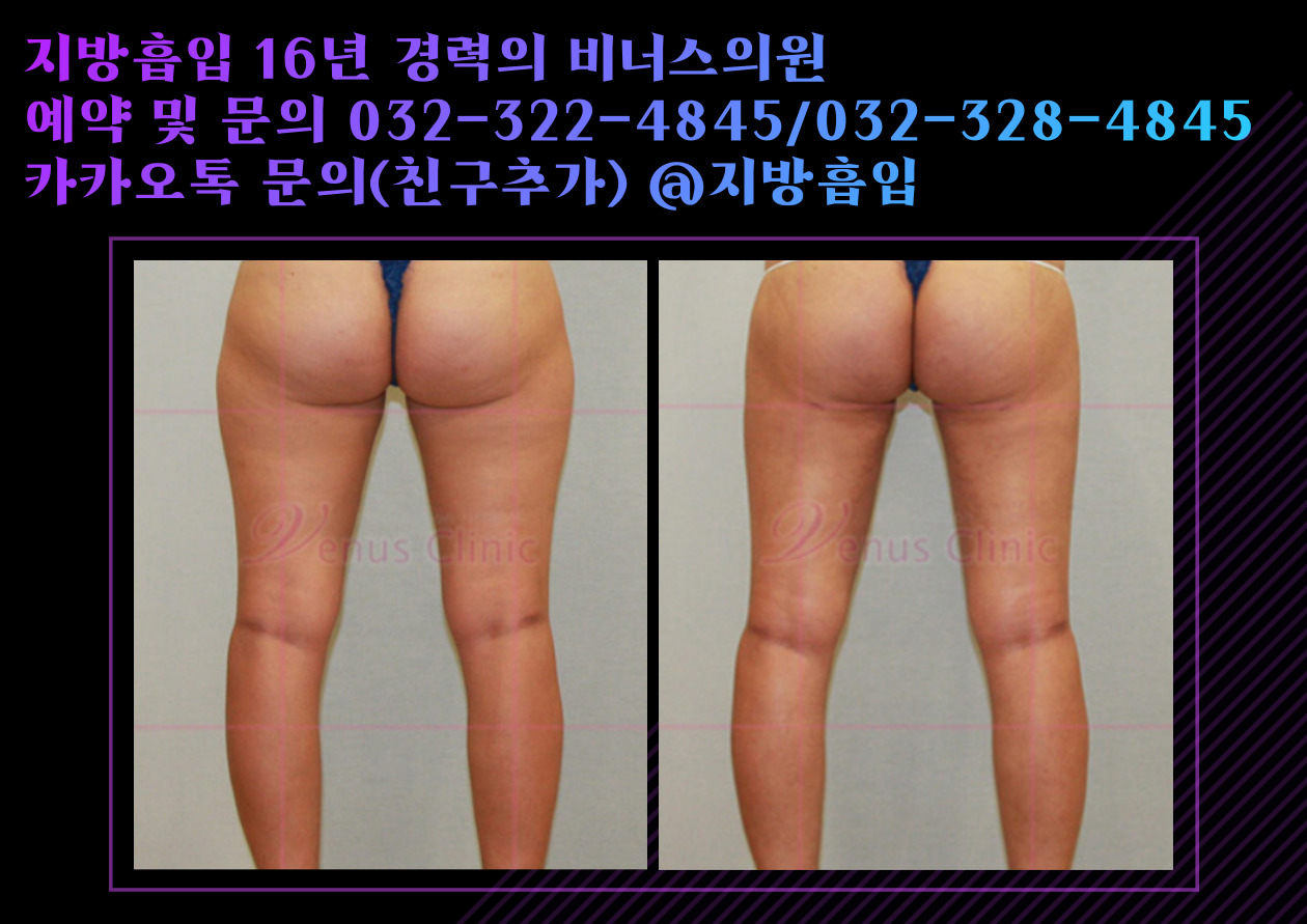 허벅지-002.jpg