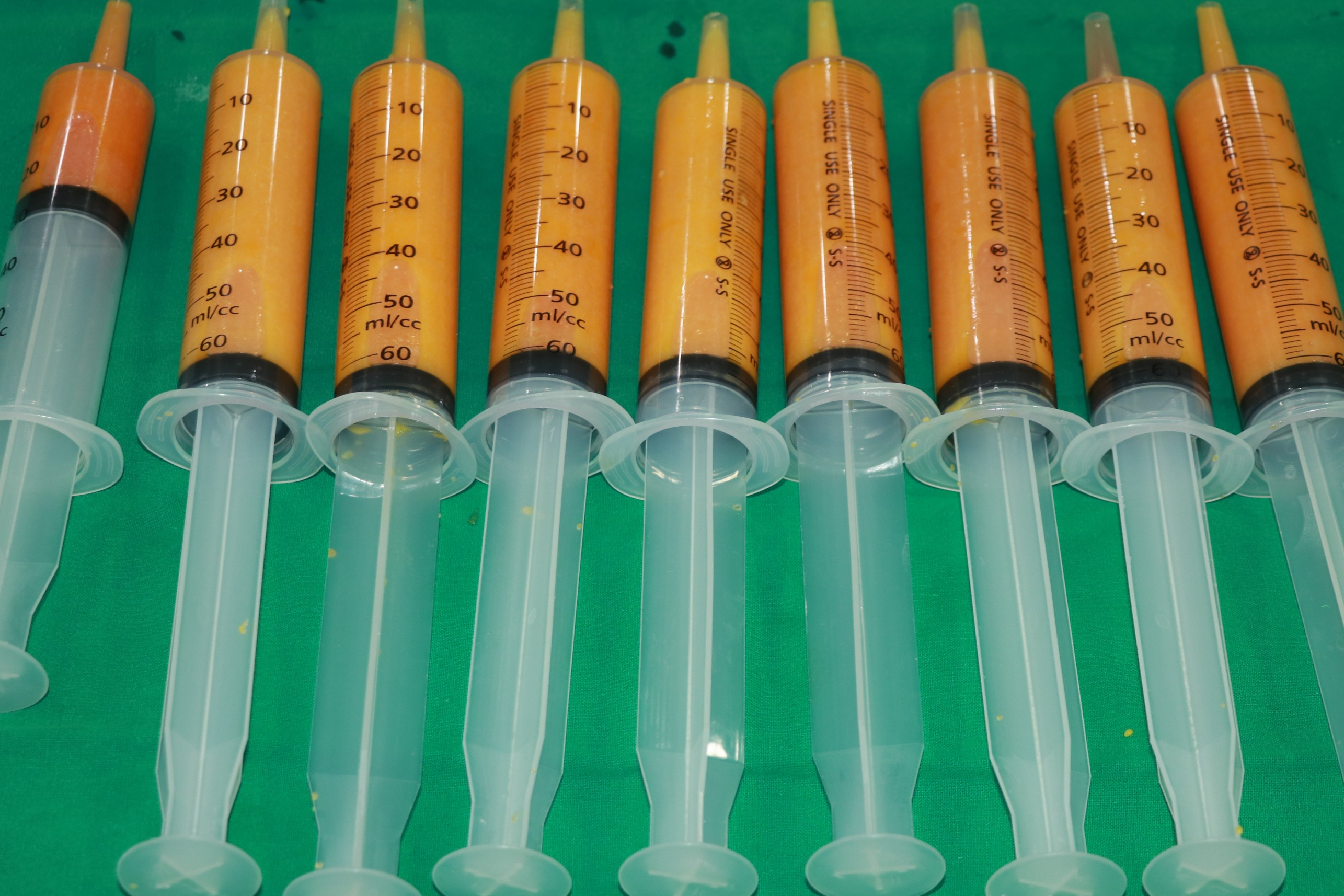 허벅지 내측, 안쪽살 뒷구리 지방흡입 엉덩이 지방이식 지방주입 지방량 주입량 이식량.jpg