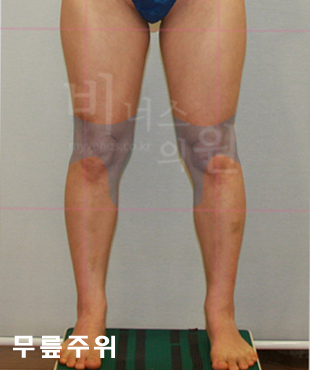 thigh_primimum 5.jpg