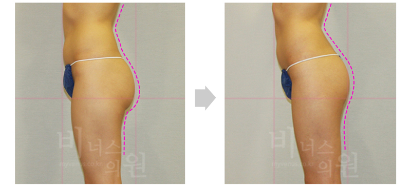 thigh_primimum 3.jpg