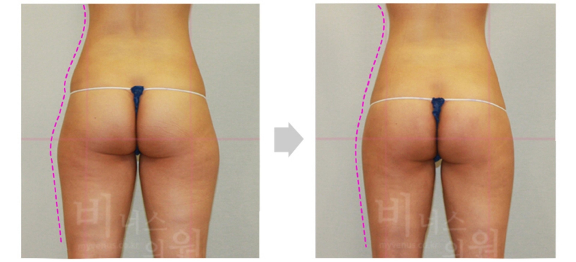 thigh_primimum 2.jpg