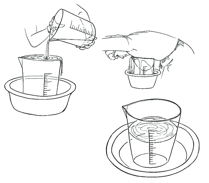 가슴축소 지방흡입-4.jpg