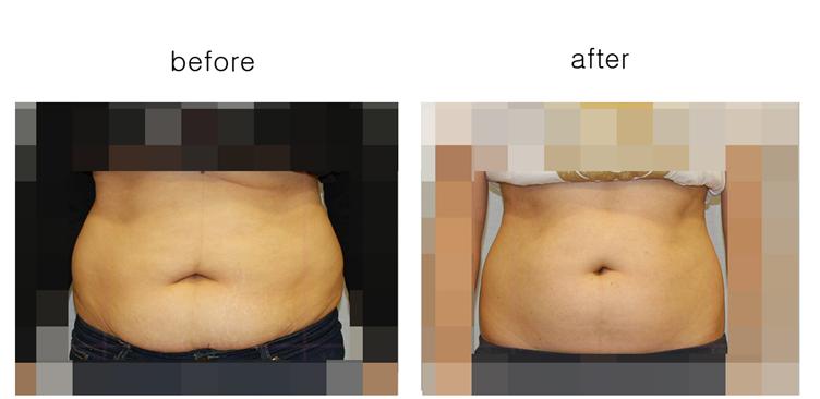 모자이크 다른인물의 비교1