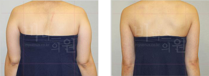 천으로 가려서 다른인물의 비교1