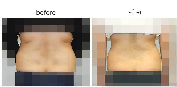 모자이크 다른인물의 비교1