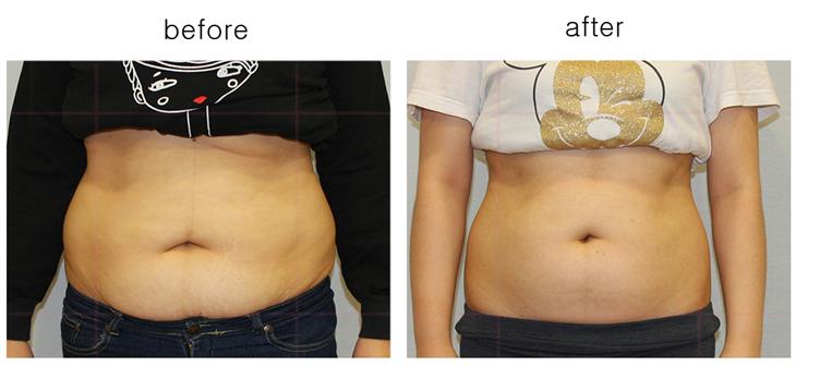 다른인물의 비교1