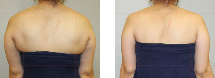 자세에 따른 체형의 변화2