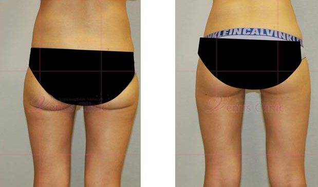 다른자세로 촬영