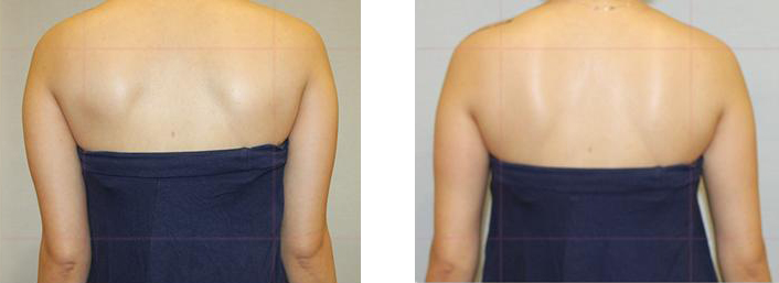 자세에 따른 체형의 변화1