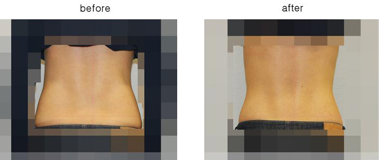 뒷모습 모자이크