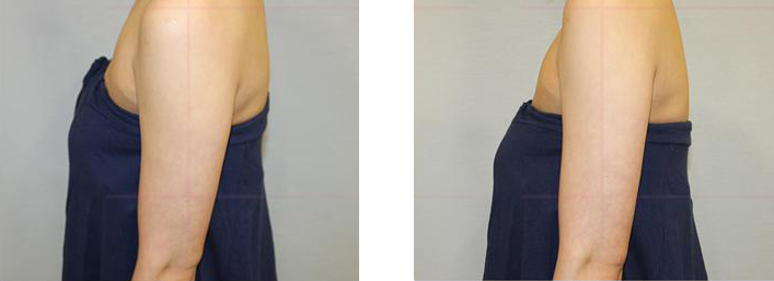 자세에 따른 체형의 변화4