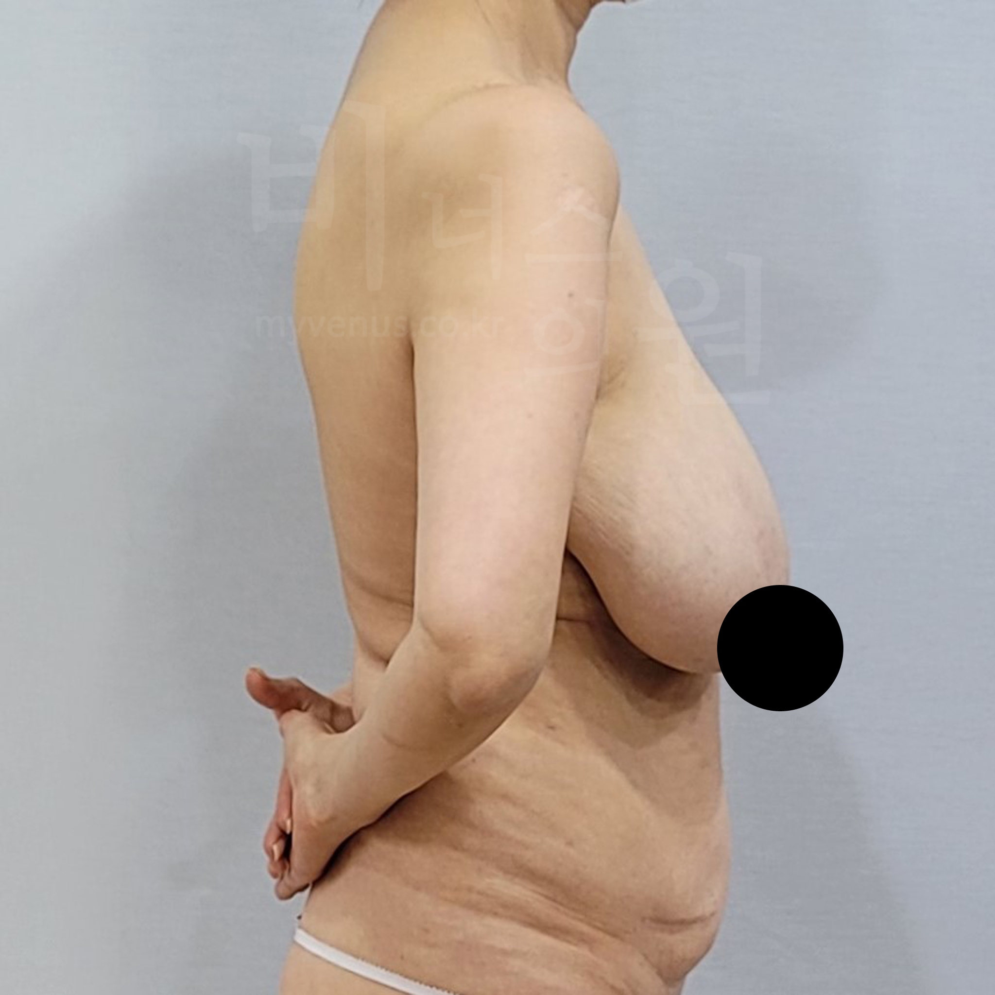 여성 상의 핏.jpg