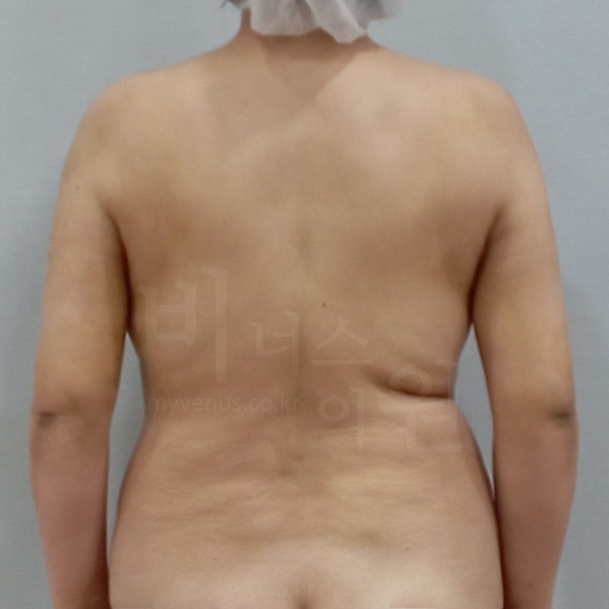 균형 잡힌 매끄러운 팔 뒤 라인.jpg