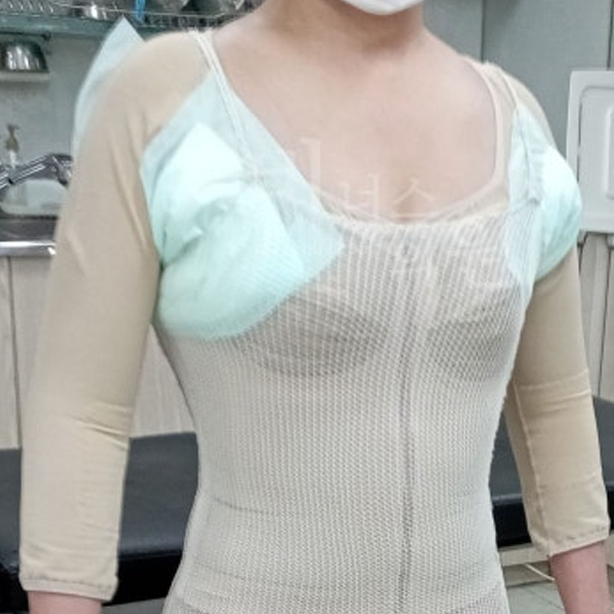 지방흡입 압박복.jpg