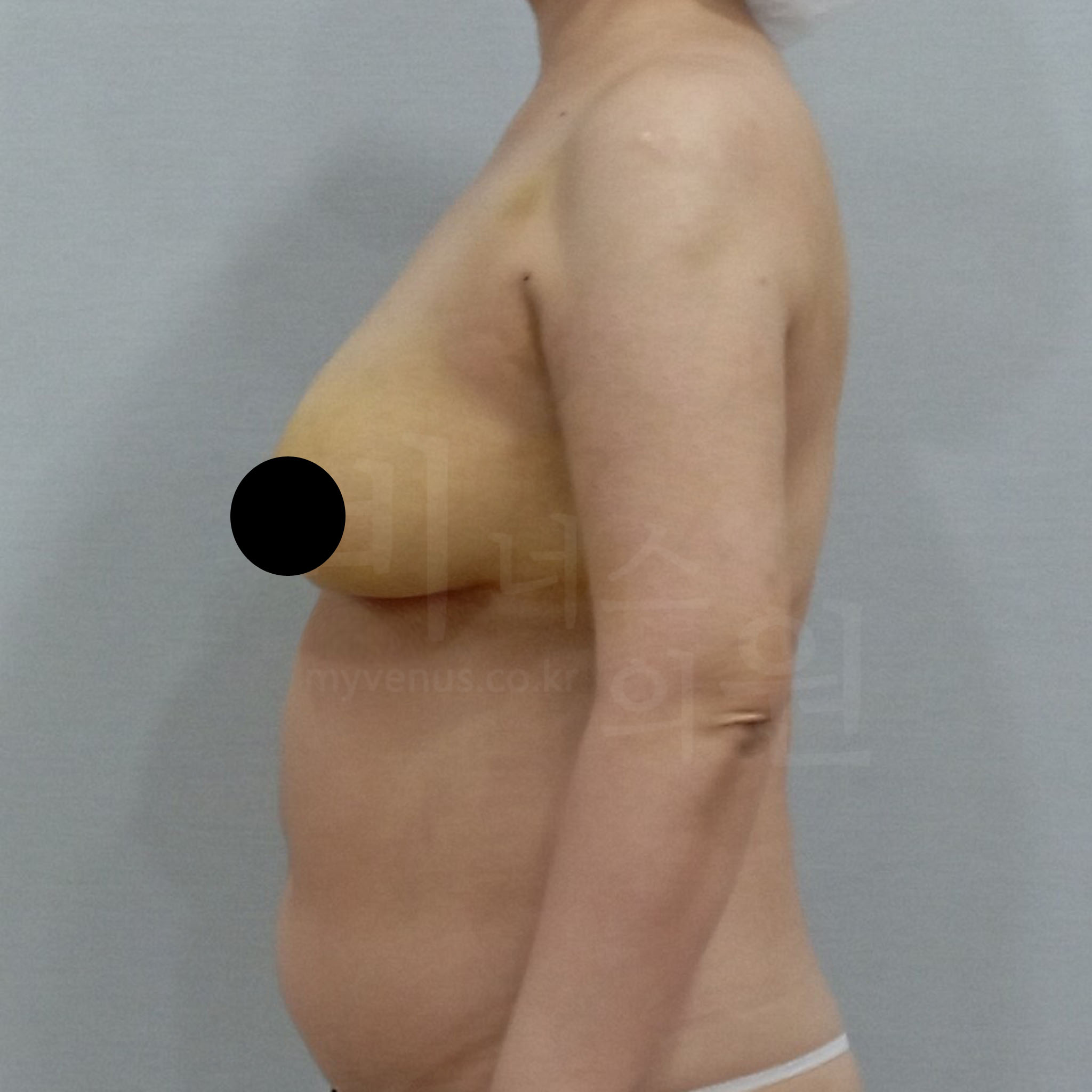 탄력 있는 곡선 팔 라인.jpg