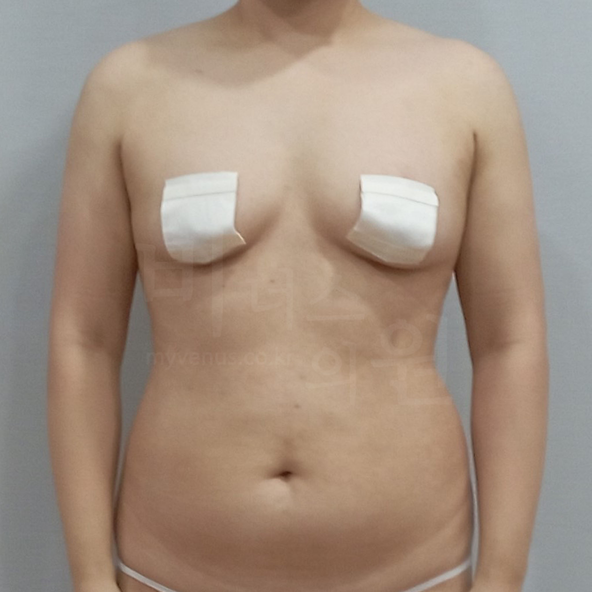 자연스럽고 균형 잡힌 팔 뒤 라인.jpg