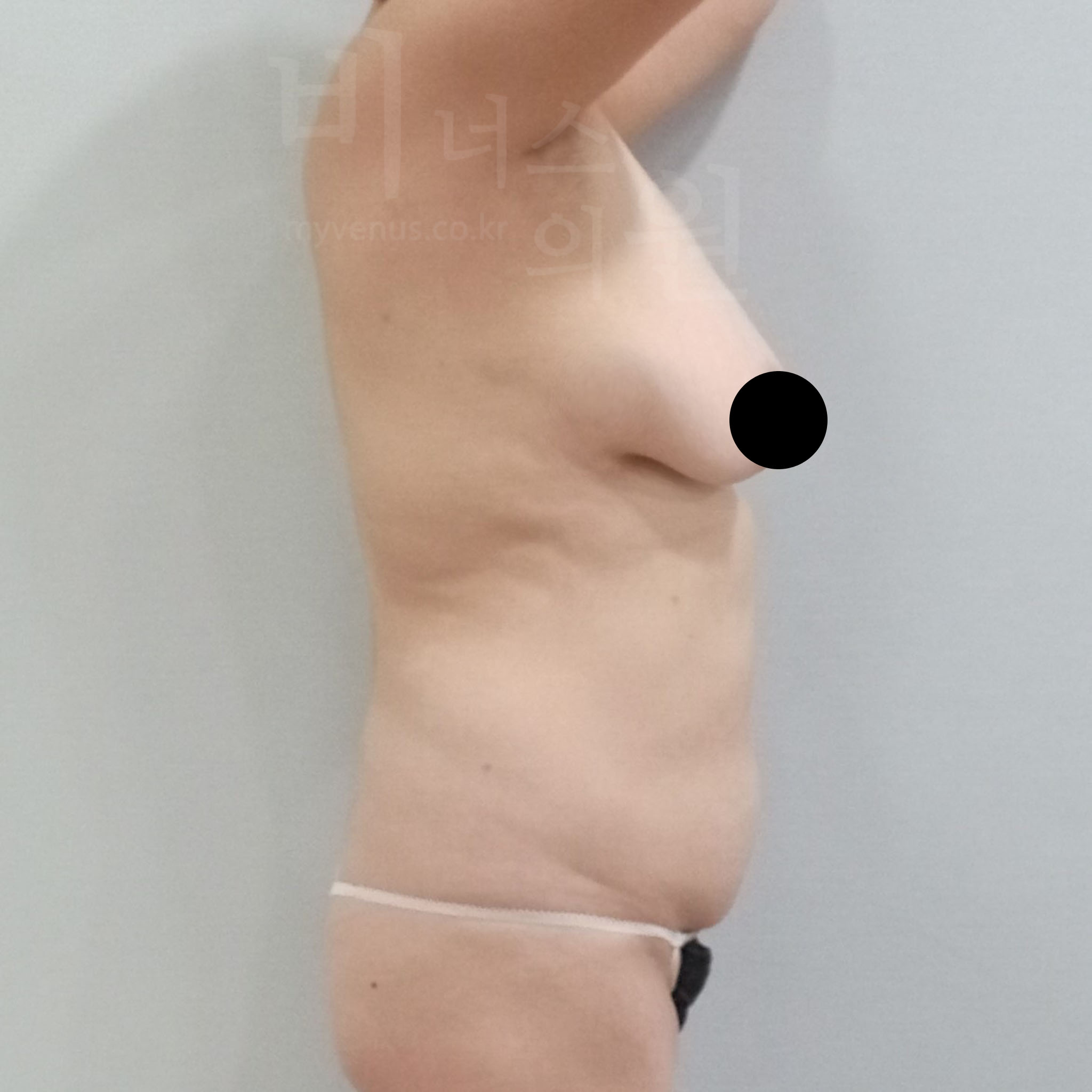크고 무거운 유방 모습.jpg
