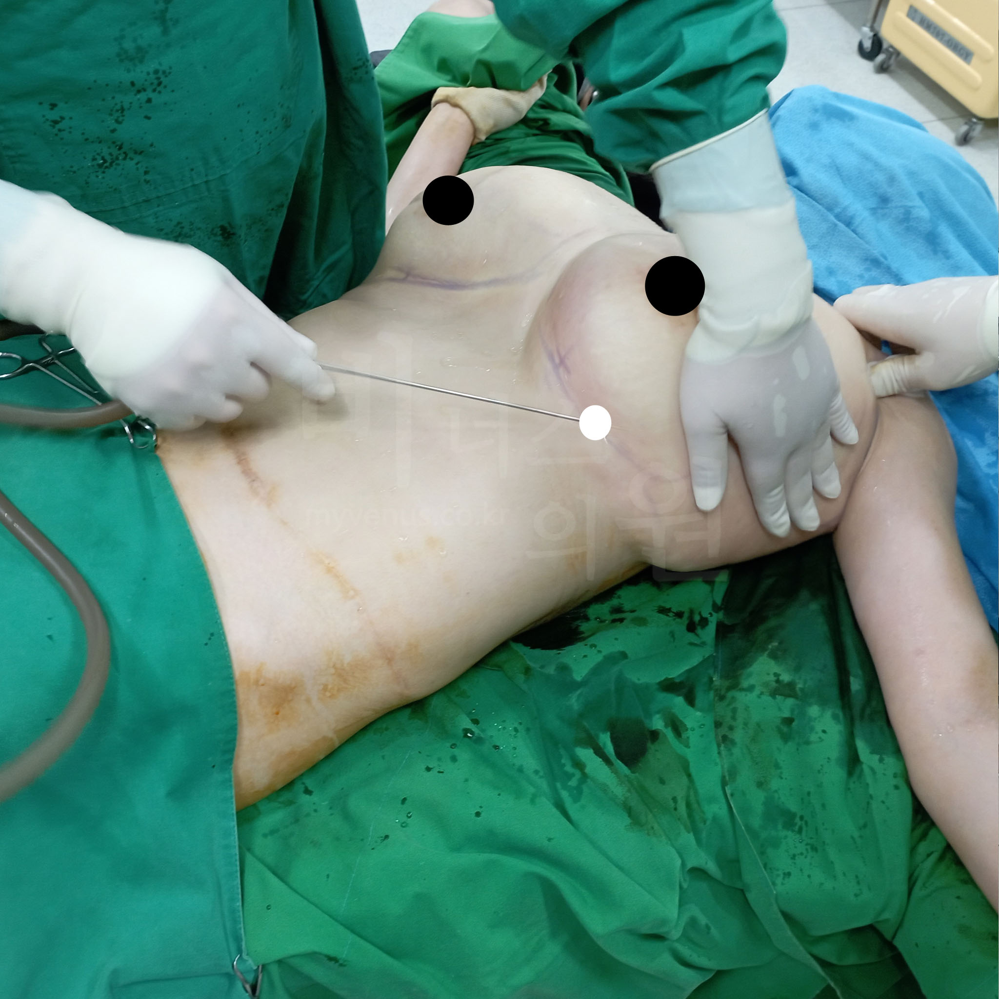 가슴 사이즈가 과도해 불균형한 상체 모습.jpg