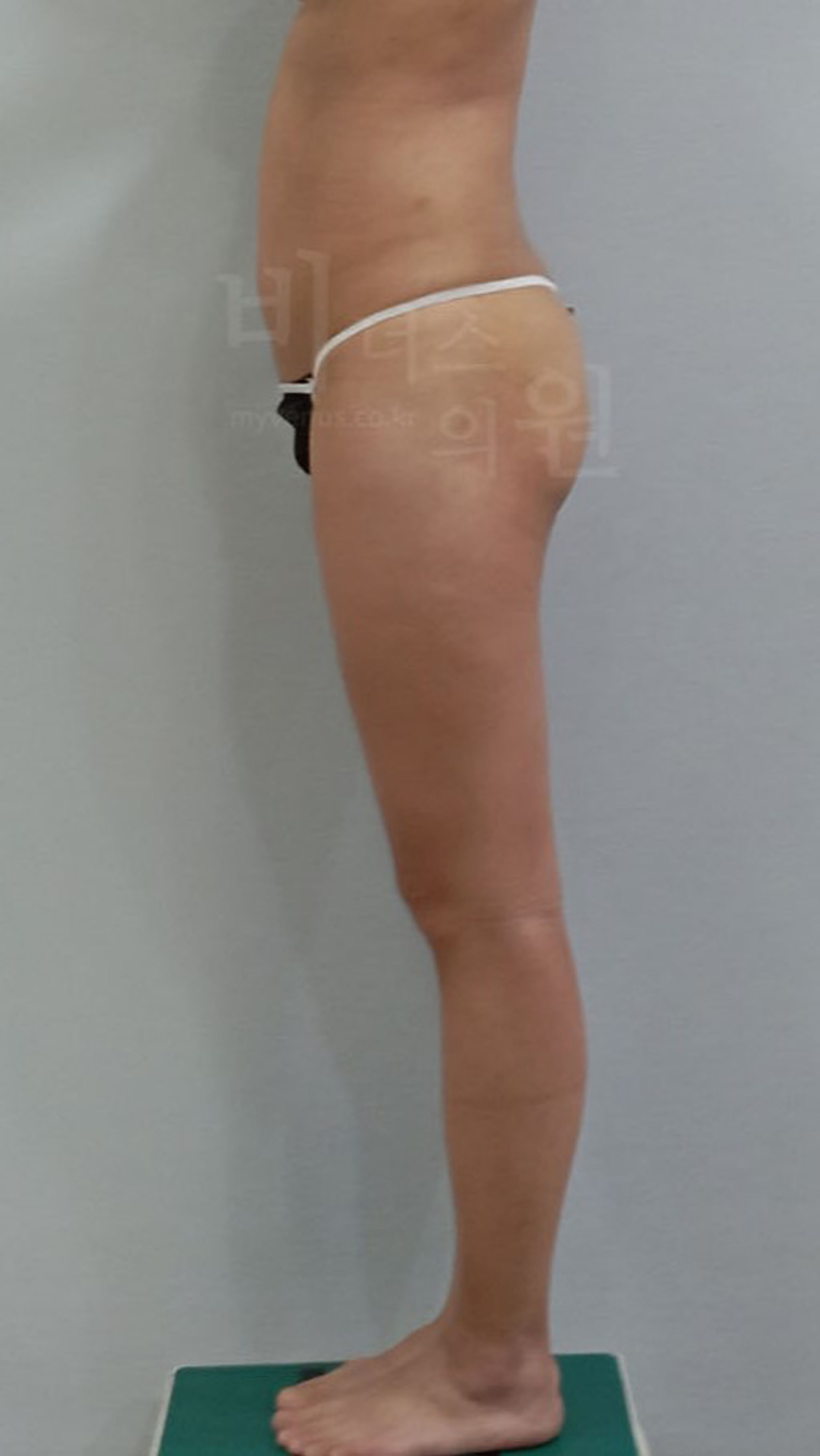 라인 중심의 완성형 뒤태.jpg