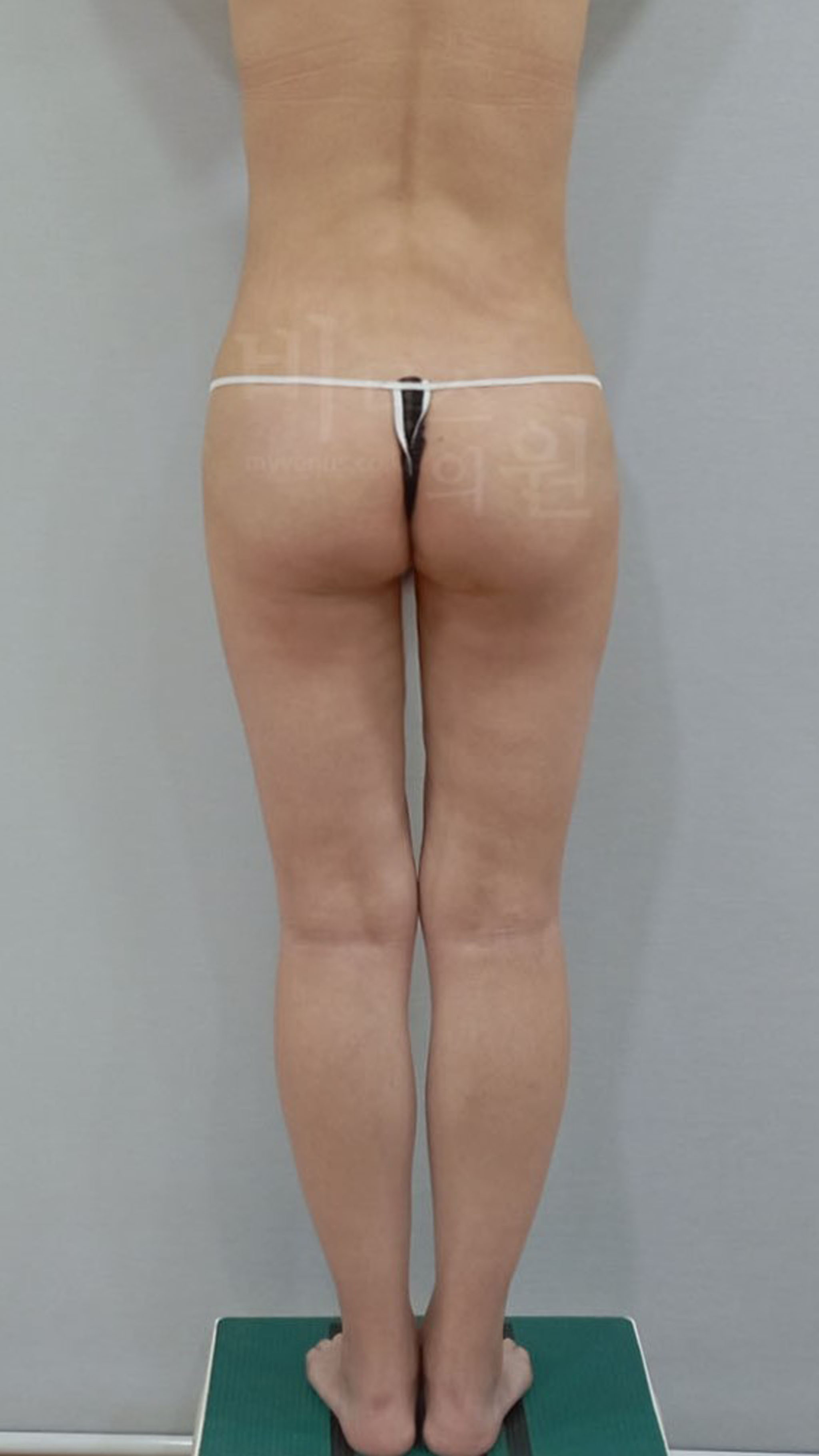 자연스럽게 자리잡은 힙 라인.jpg