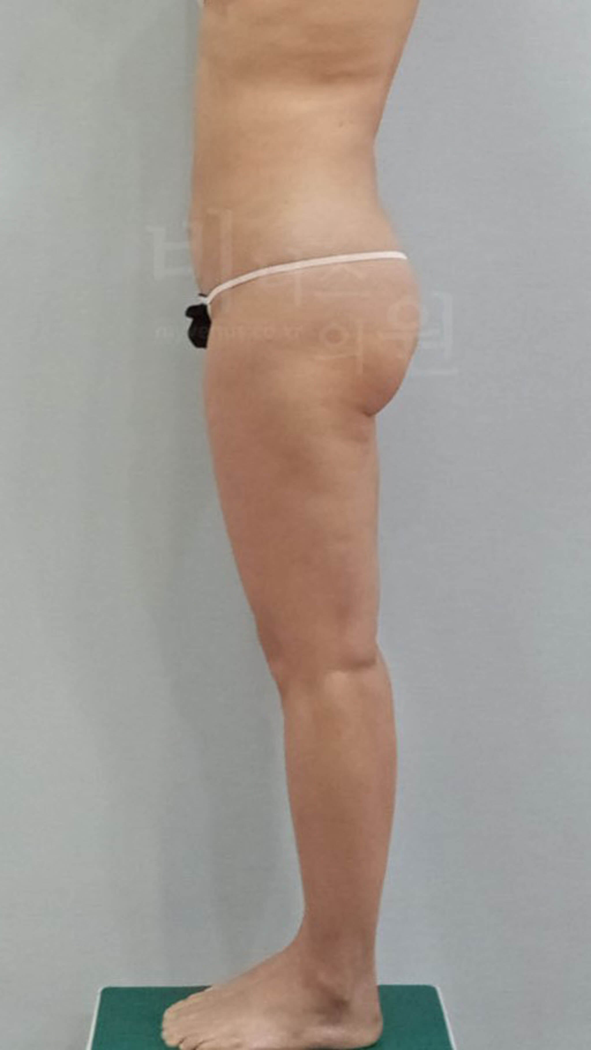 애매했던 허벅지 라인.jpg