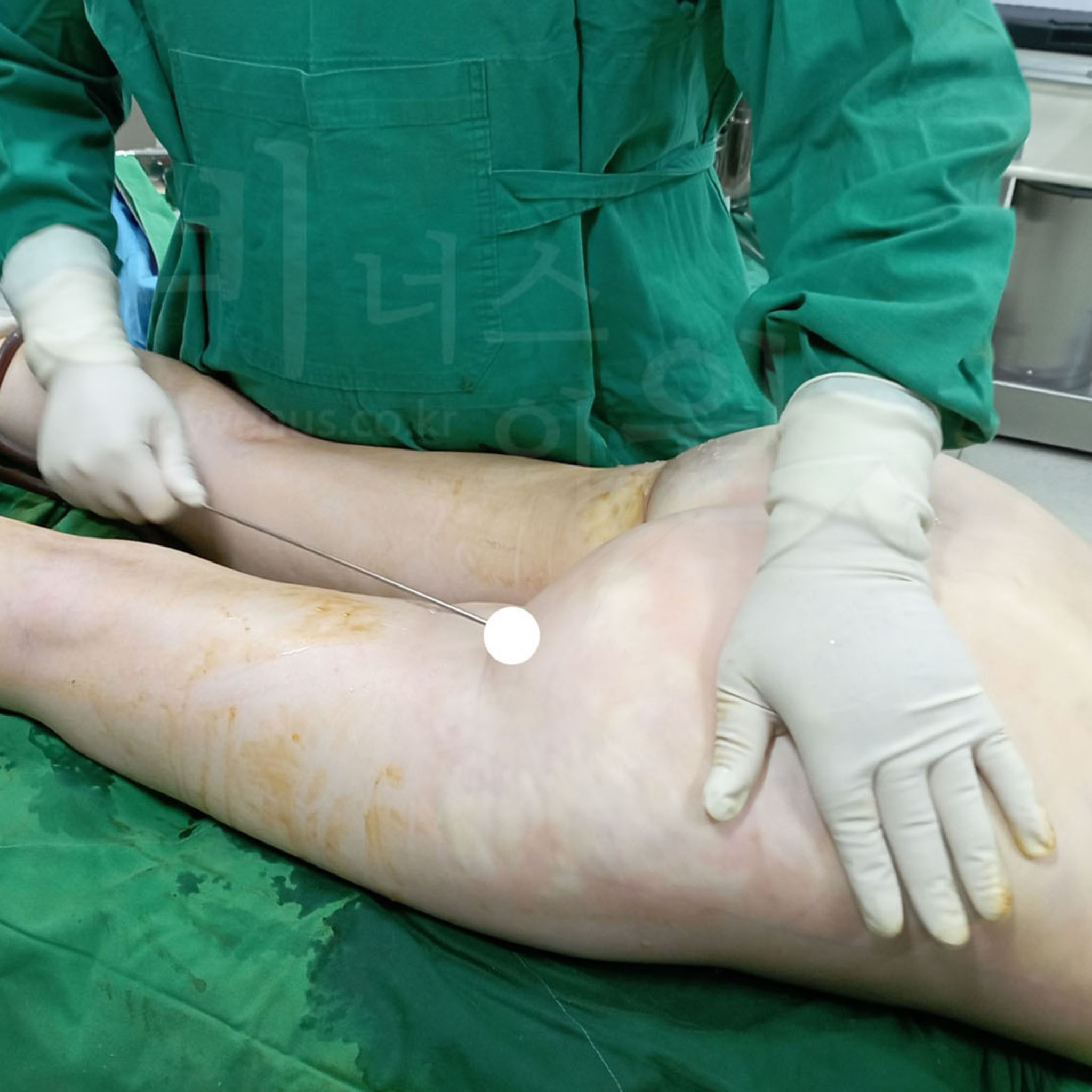 무너진 힙 라인과 무거운 뒤태.jpg