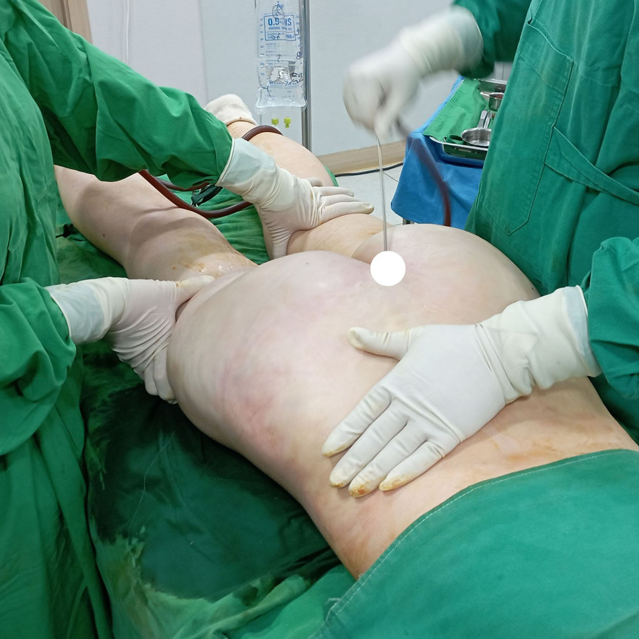 힙 아래 정리된 실루엣.jpg