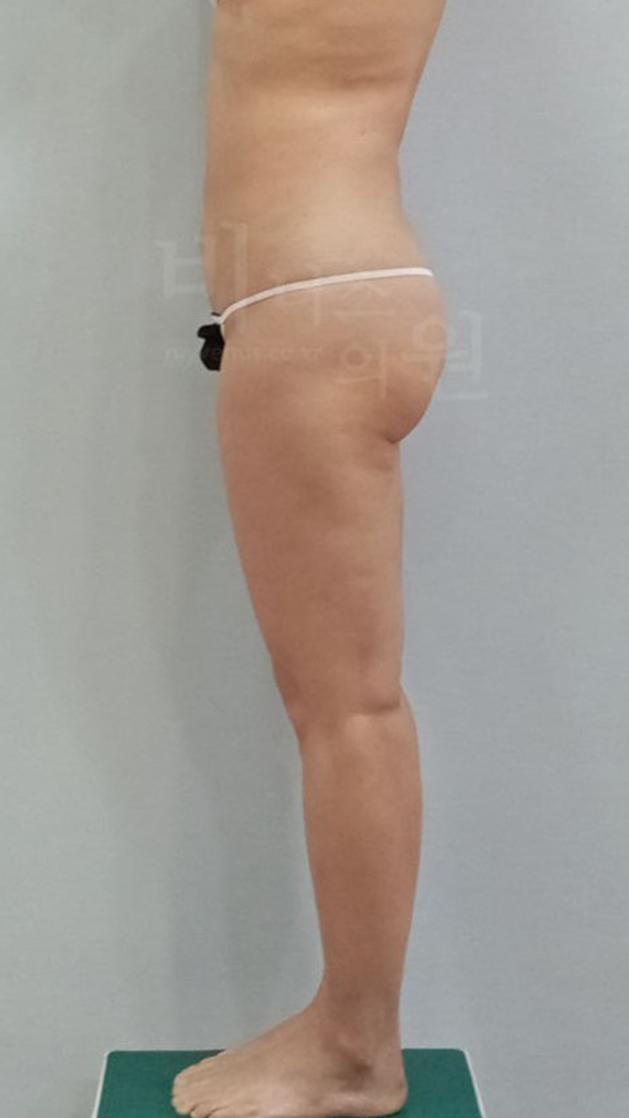  힙업된 라인과 허벅지 경계 뚜렷.jpg