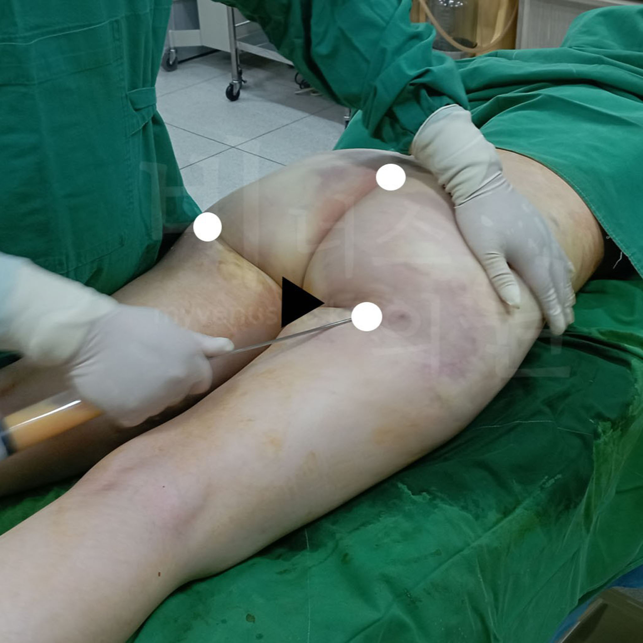 높아진 힙과 슬림한 옆태.jpg