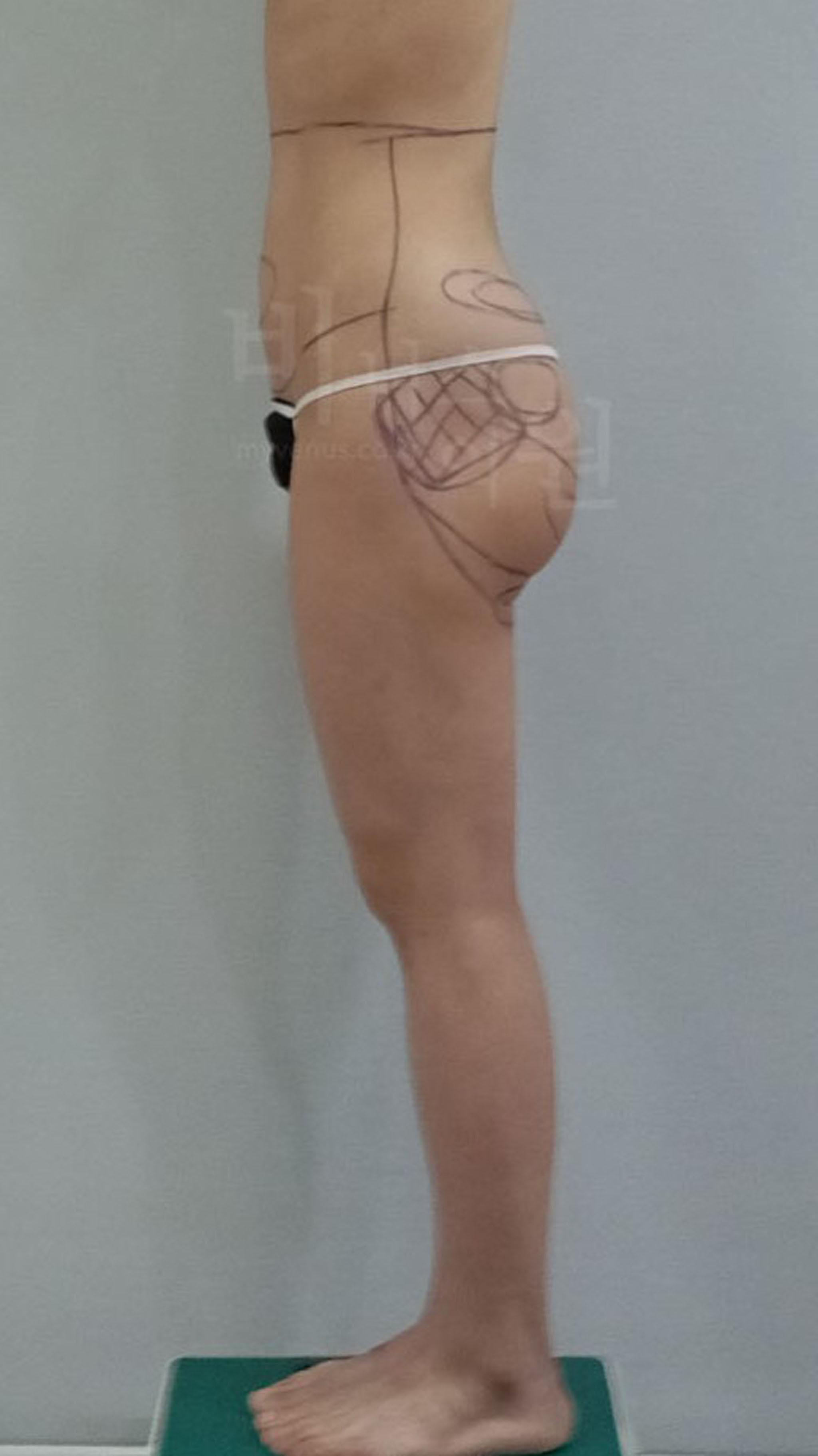 허리와 힙의 경계가 모호한 옆태.jpg